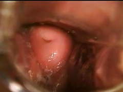 KiloTube presents: Gyno speculum exam